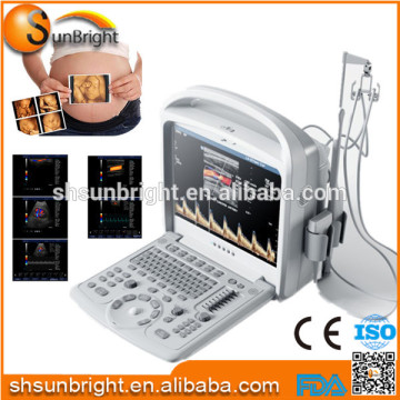 Color Ultrasound scanner Liver Ultrasound kidney Ultrasound color doppler