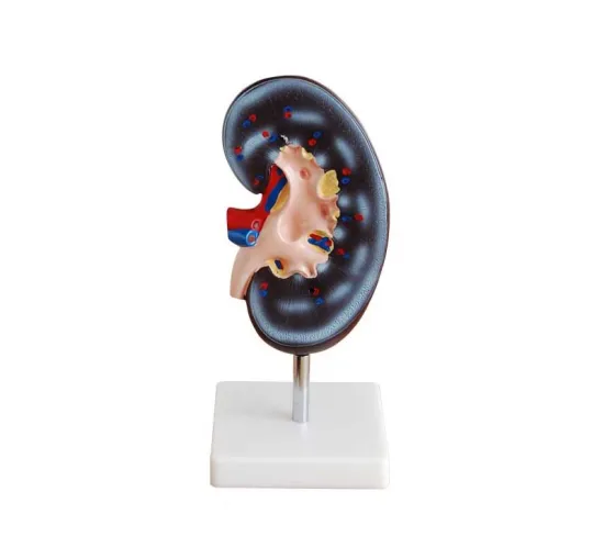 Medical Kidney Model 1 Part