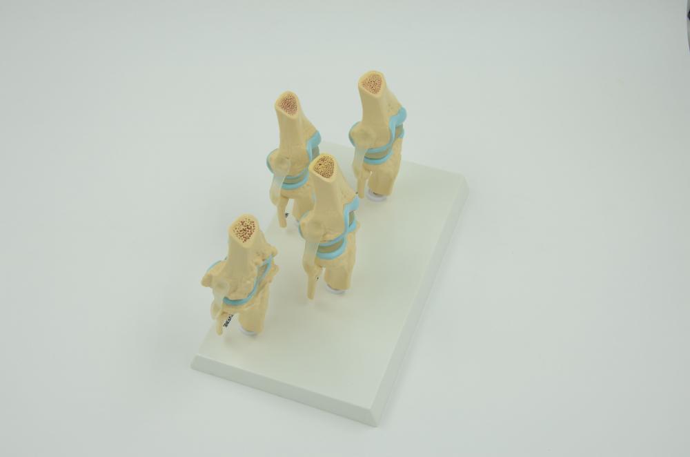 LESION KNEE JOINT MODEL