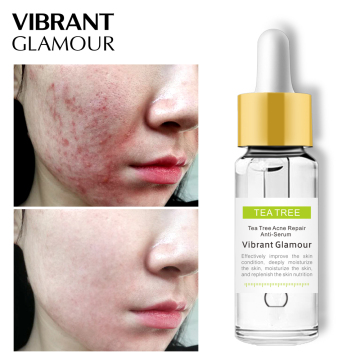 Vibrant Glamour Tea Tree Repair Face Serum Essence for Uneven Skin, Anti-Acne, and Pore Shrink