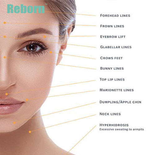 Reborn dermal filler near me