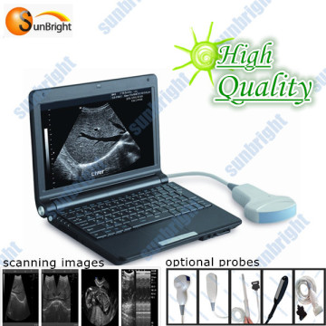 portable pc-based ultrasound equipment