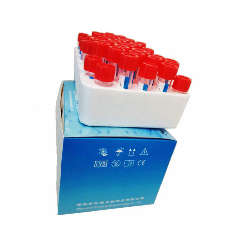 50t Sars-cov-2 Nucleic Acid Sample Release Reagent Testing Kit Rapid ...