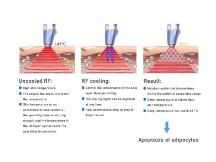 High Quality EMS Slimming Equipment for Body Weight Loss