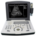 Portable Black And White Ultrasound Scanner for Cardiology