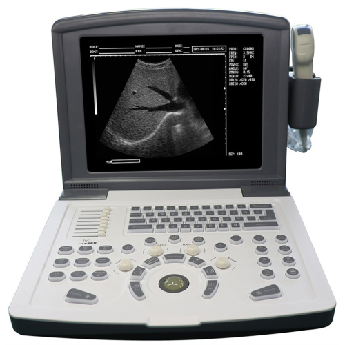 Portable Black And White Ultrasound Scanner for Cardiology