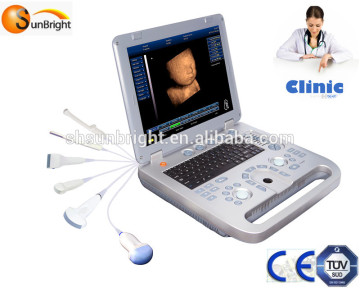 15" LCD Touch Screen Portable Ultrasound