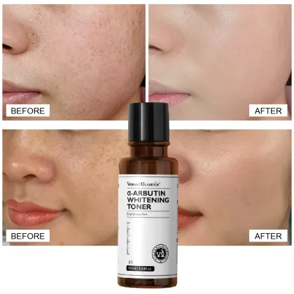 VIBRANT GLAMOUR Arbutin Whitening Skin Brightening Serum Toner for Men and Women