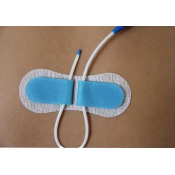 Medical Catheter Fixation Devices: CVC/PICC Securement Kits and Fistula Dressing