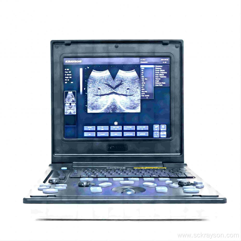 Female gallstones ultrasound diagnosis instrument