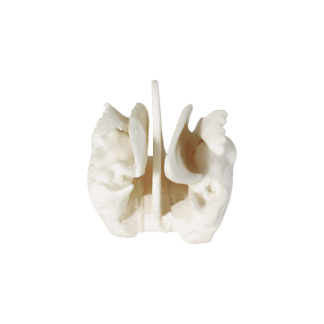Enlarged Ethmoid Bone ZM1017 20x15x16