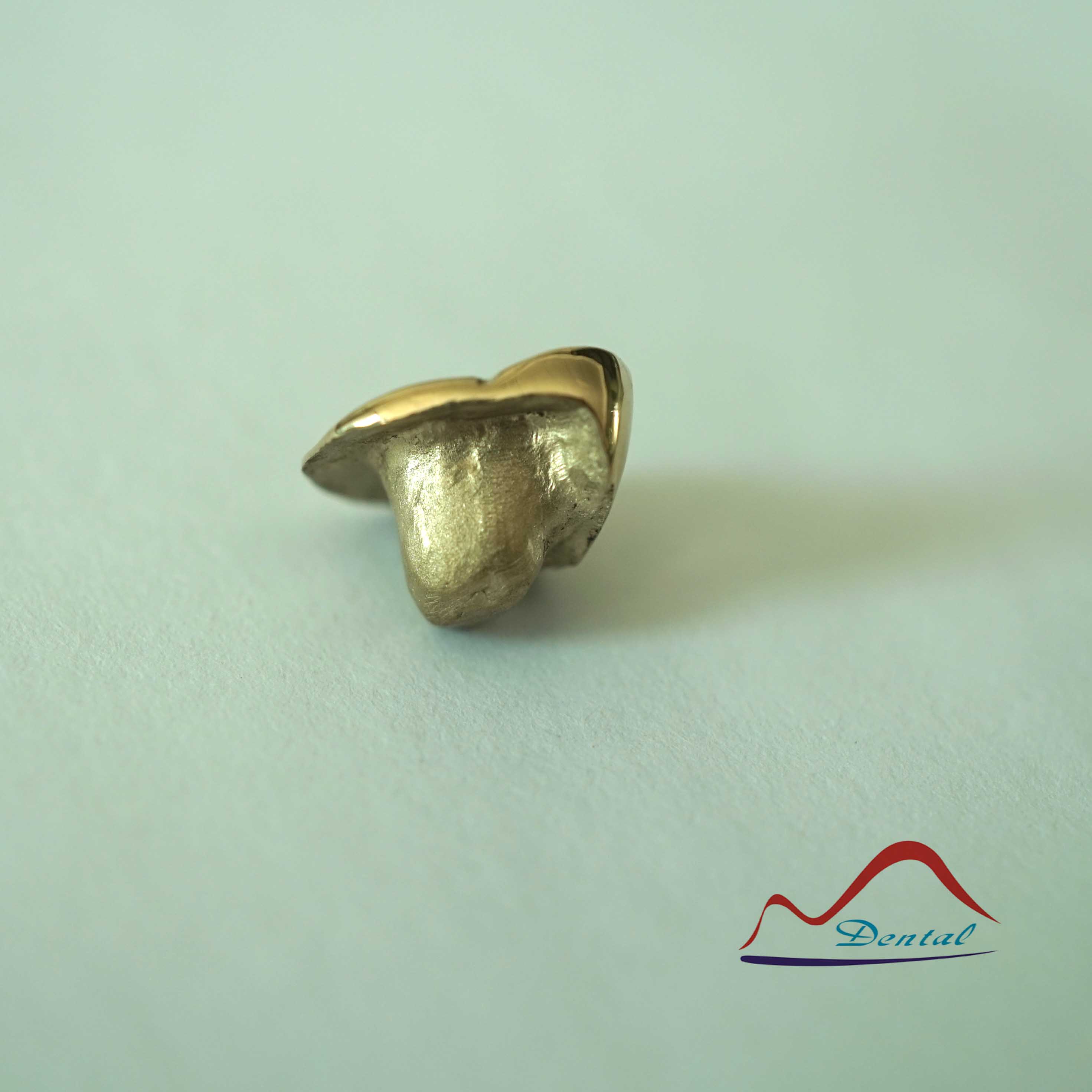 DENTAL Molar Gold Onlay a