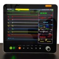 Medical 15inch Patient Monitor