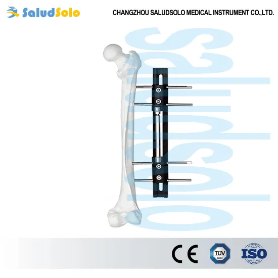 Bone Lengthening External Fixator