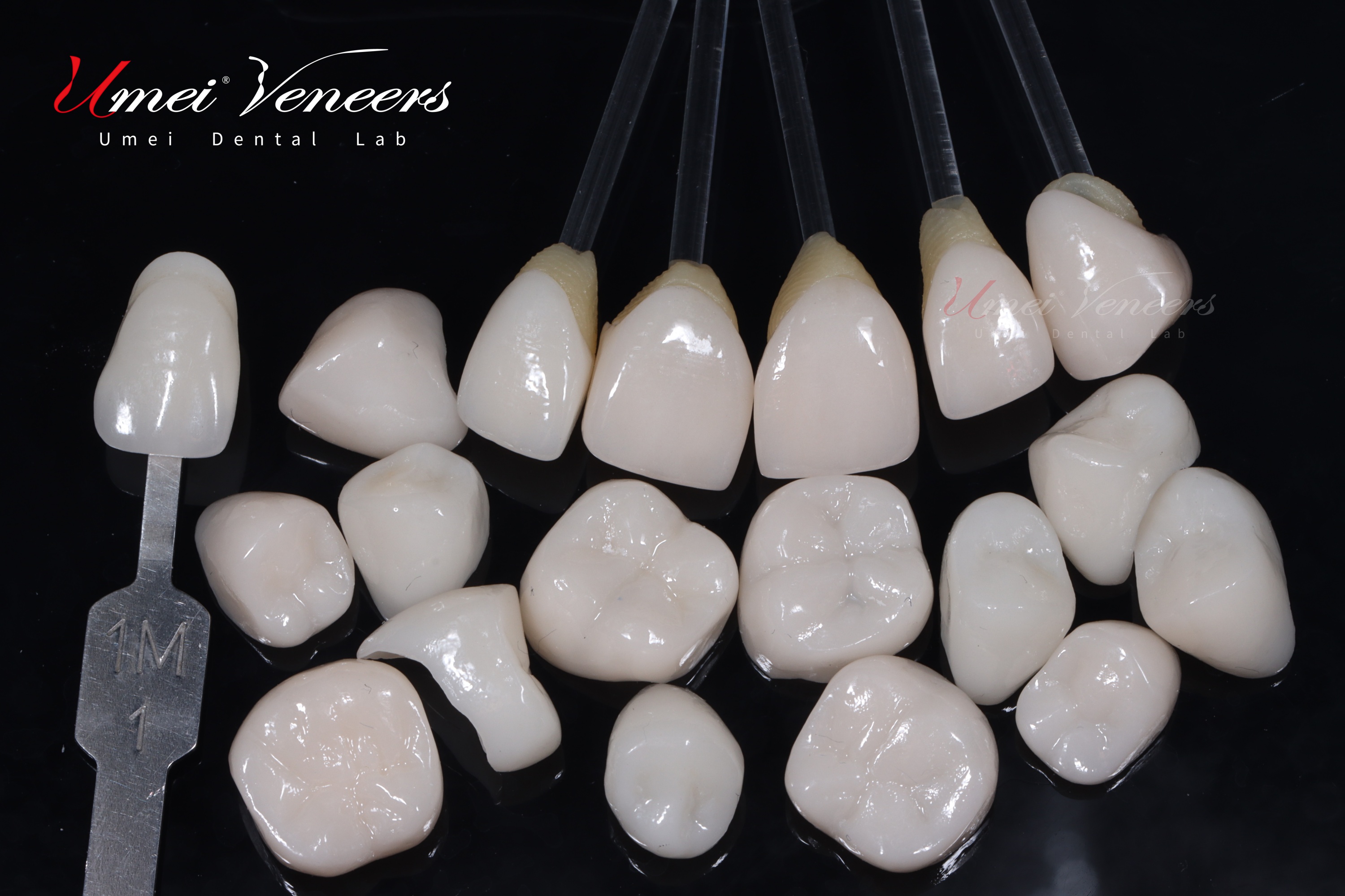 Zirconia Layered Veneers