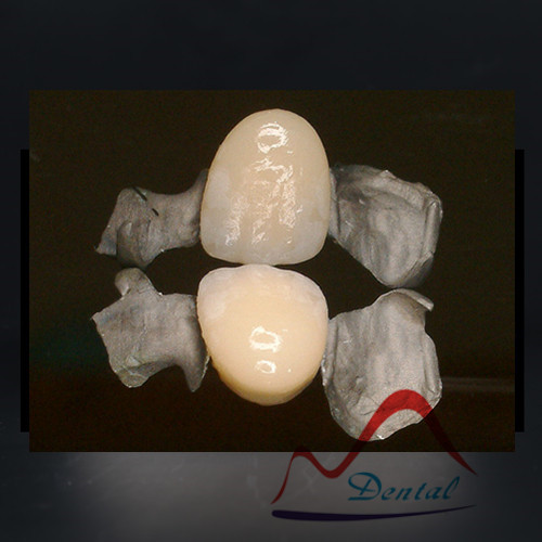 Pfm 메릴랜드 다리 앞쪽 및 후부, 고품질 Pfm 메릴랜드 다리 앞쪽 및 후부