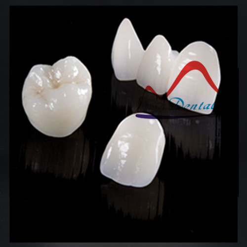 Dental Porcelain Empress/Emax crown/Bridge