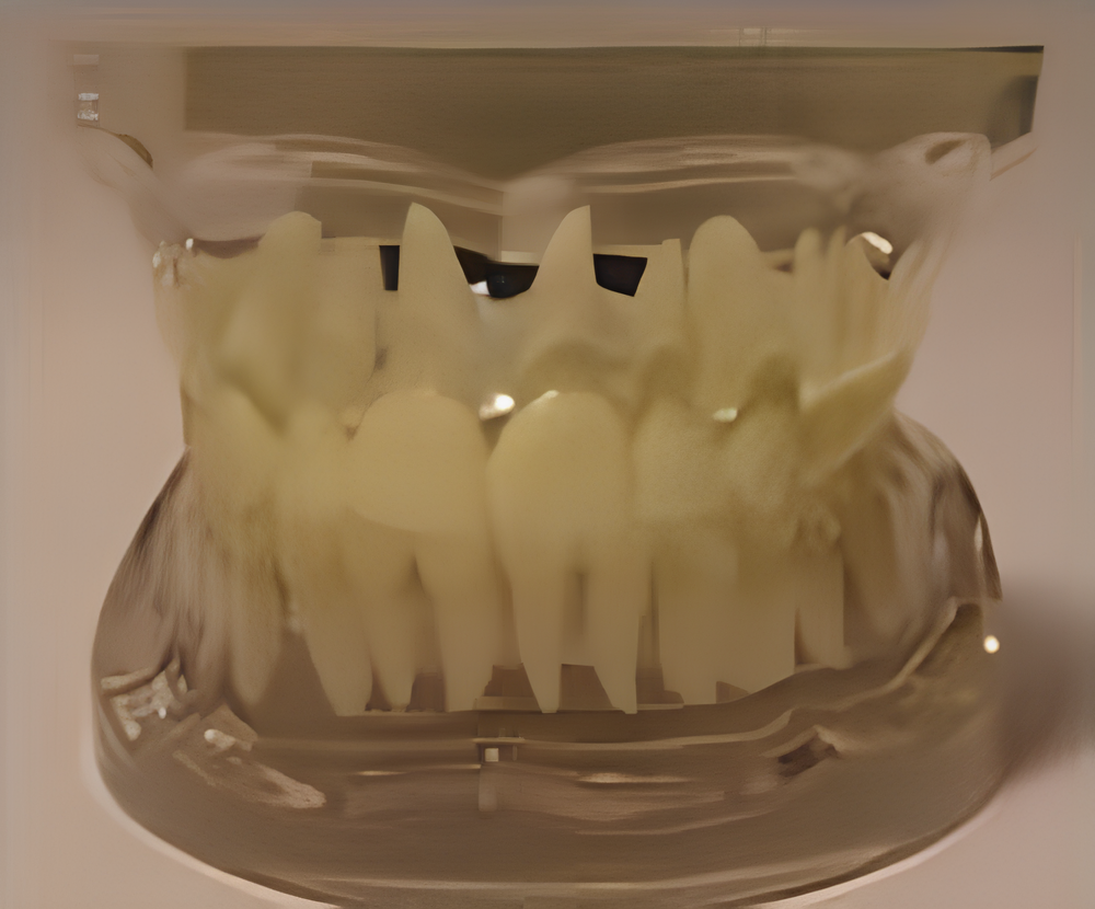 Прозрачная модель зубов взрослых