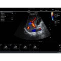 KPC-3C Convex Palm Doppler ультрагукавая сістэма