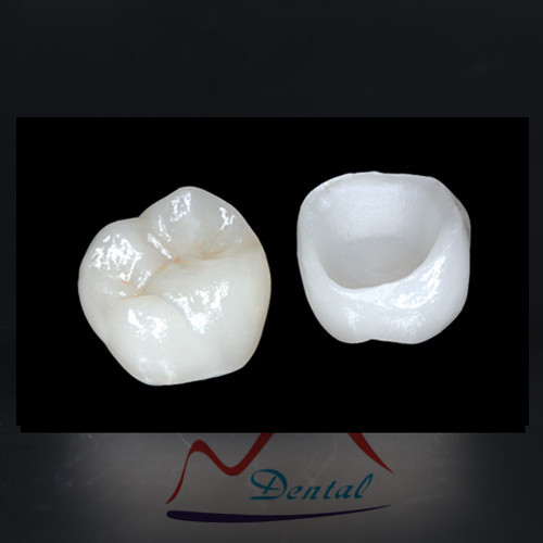 High Quality Dental IPS Emax Cosmetic Crown All Ceramics