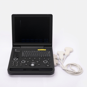 Female gastric ulcer ultrasound diagnostic instrument