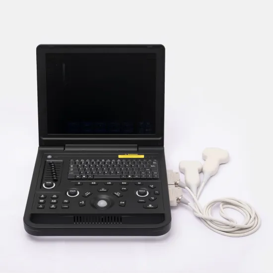 Female gallbladder polyps ultrasound diagnosis instrument