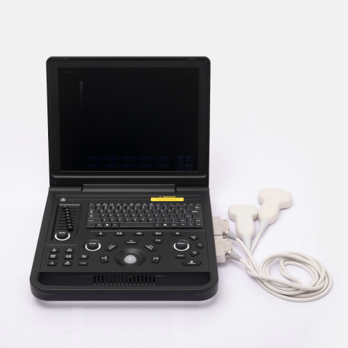 Female cirrhosis ultrasound diagnostic instrument