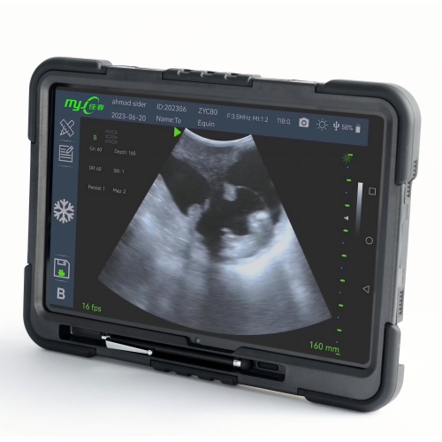 Fast Scan C for pig ultrasound