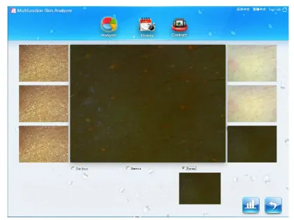 Portable Skin Analysis Device For Skin Uv / Base Layer Detection