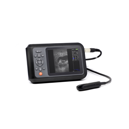 SONO V6 wired ninny ultrasound