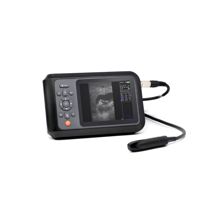 SONO V6 wired ninny ultrasound