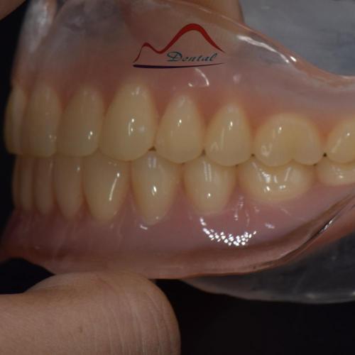 Beauty Clear Complete Denture
