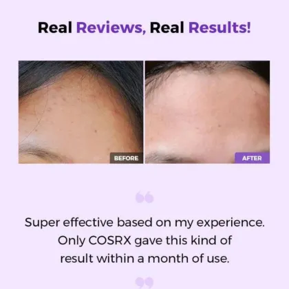 Wholesale Cosrx Facial Exfoliating Spray: AHA/BHA Clarifying Treatment Toner (150ml) for Removing Whiteheads