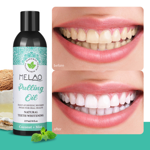 Pulling Oil For Teeth Whitening Oral Hygiene
