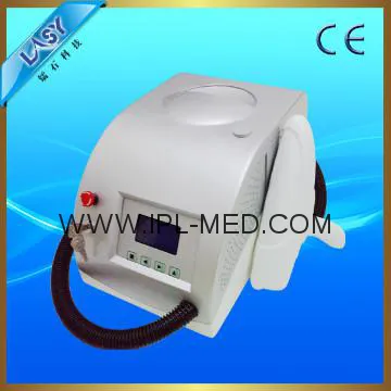 tattoo removal laser nd yag laser