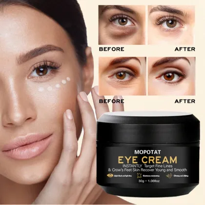 MOPOYAT Eye Cream 30g - Smoothing, Firming & Brightening for Dark Circles & Eye Wrinkles