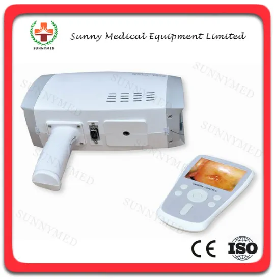 SY-F005 Digital portable colposcopy medical equipment gynecology
