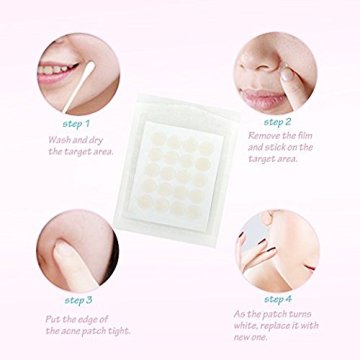 Adesivo per adesivi per attre -idrocolloide di punti Adesivo per acne idrocolloide