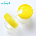 Thử nghiệm bệnh nhân đờm vòm phân