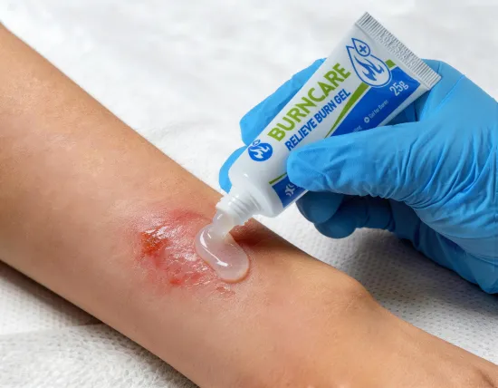 Burn Gel Dressing