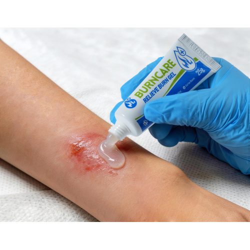 বার্ন জেল ড্রেসিং