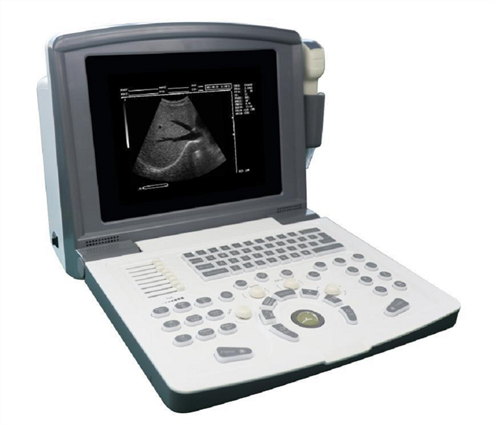 Scanner de ultrassom preto e branco portátil para urologia