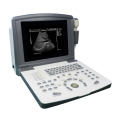 Scanner de ultrassom preto e branco portátil para urologia