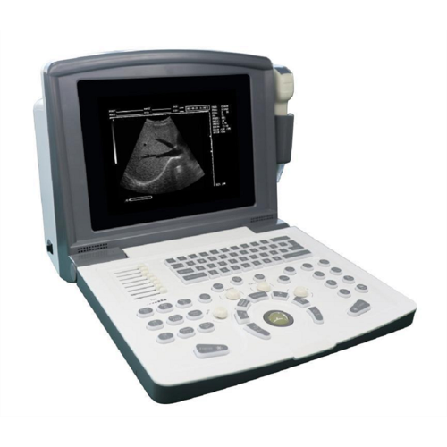 Portable Ultrasound Scanner Portable Black And White Ultrasound Scanner for Urology Manufactory