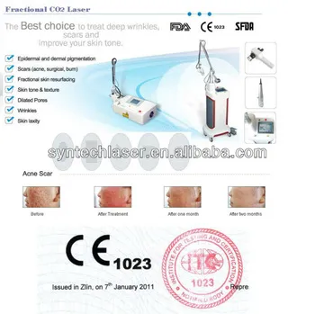 60W Fractional Co2 medical Laser with medical Ce,FDA