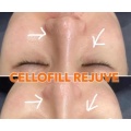 Korea Origin Cellofill Rejuve for Skin Face Reguventing Anti Aging 3ml * 6vials Skin Booster Dermal