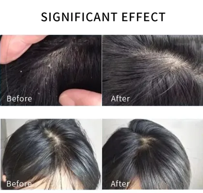 Nourishing Deep Cleansing Anti Dandruff Hair Shampoo