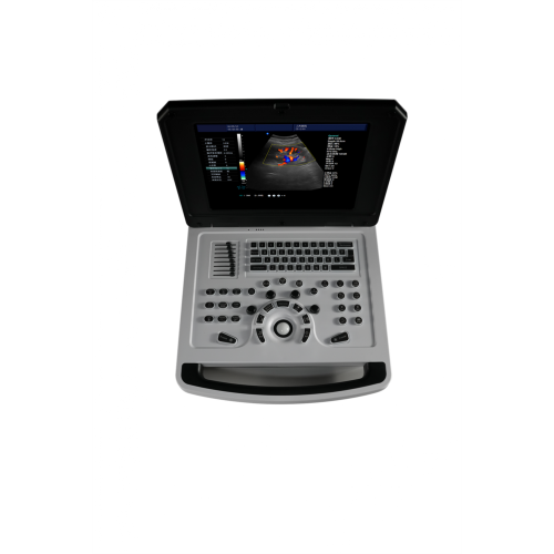 Notebook Color Doppler Ultrasound Scanner for Vascular
