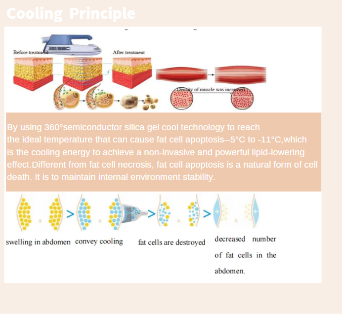 The working principleof EMS body sculpting slimming machine