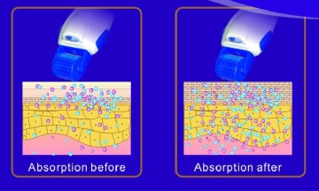Photon Microneedle Derma Roller (AP5-B)